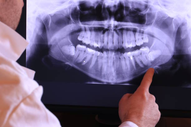 Best Emergency Gum Treatment in Ashland, PA